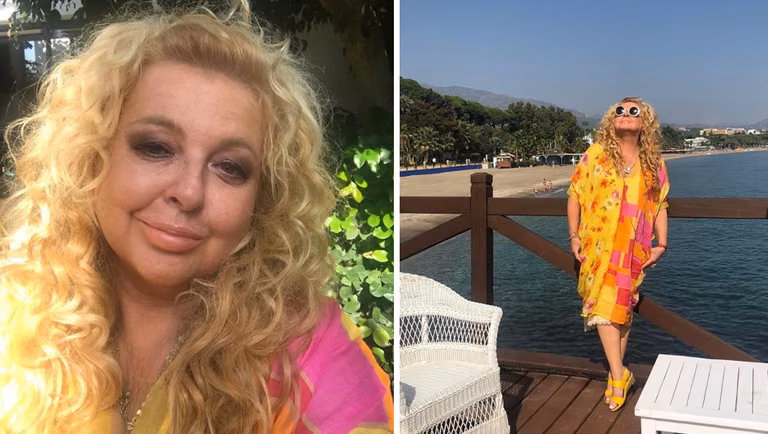 Magda Gessler ujawnia, co się stało z jej twarzą i ostro odpowiada na krytykę
