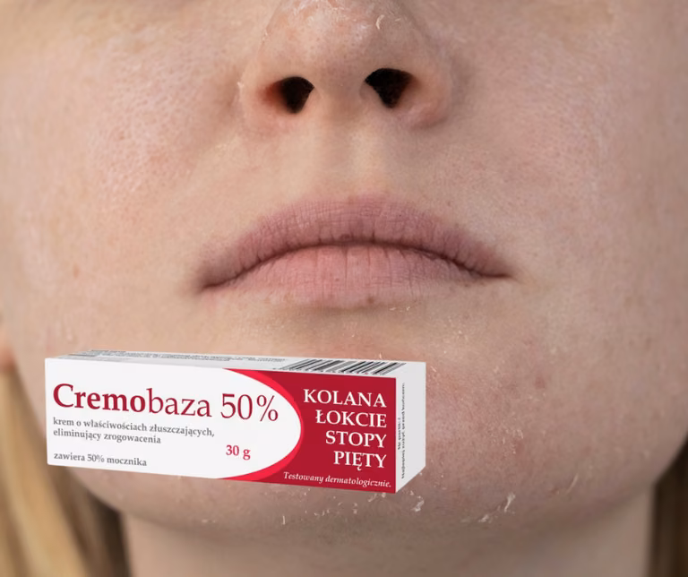 Cremobaza - hit z apteki, który musisz mieć! Trzy stężenia i trzy różne przeznaczenia.