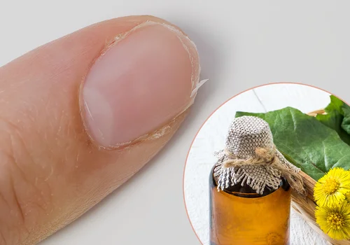 Ten syrop na kaszel działa też na… łamliwe paznokcie! Sprawdź, jak go stosować!