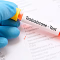 Jakie są objawy niedoboru TESTOSTERONU?