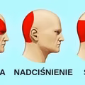 Pozbądź się BÓLU GŁOWY w 5 minut bez TABLETEK!