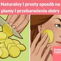 Naturalny i prosty sposób na plamy i przebarwienia skóry
