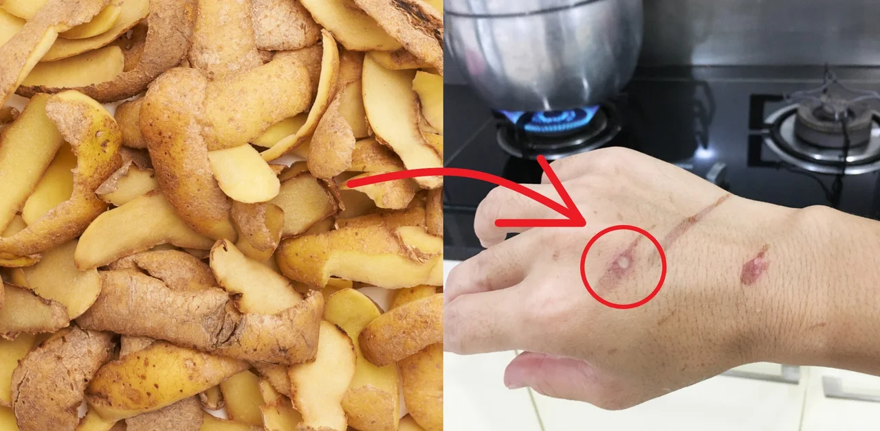Niesamowite wykorzystanie skórek z ziemniaków! Od tej pory już ich nie wyrzucisz!