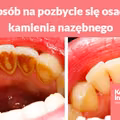 Prosty sposób na pozbycie się osadu i kamienia nazębnego.