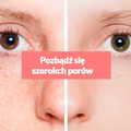 Pozbądź się szerokich porów za pomocą kilku domowych składników!