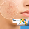Hit z apteki za 18 zł na przebarwienia i tłustą cerę! Zaskakujące właściwości Acne-derm!