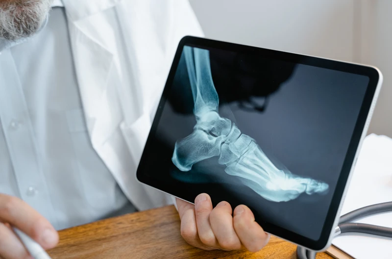 Międzynarodowy Dzień Świadomości Fibrodysplasia Ossificans Progressiva (FOP)