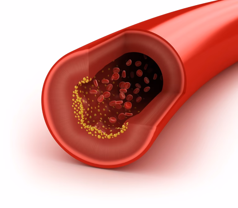 Sposób na obniżenie cholesterolu!