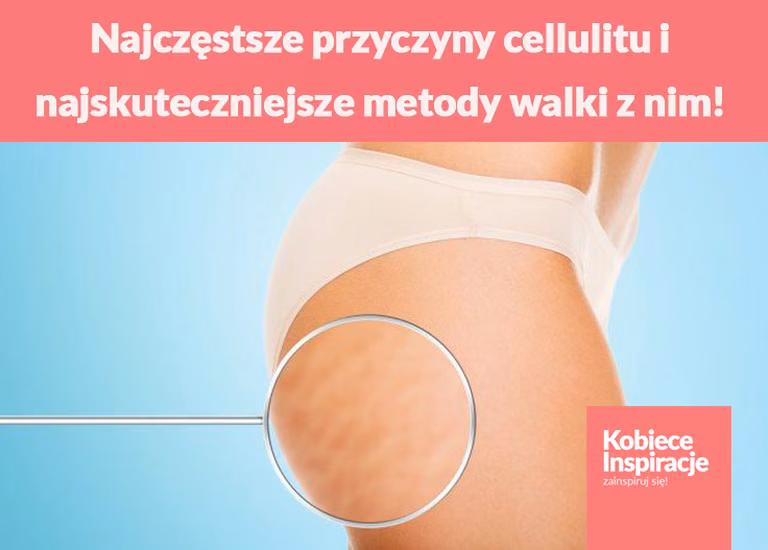 Najczęstsze przyczyny cellulitu i najskuteczniejsze metody walki z nim!