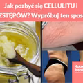 Jak pozbyć się CELLULITU i ROZSTĘPÓW? Wypróbuj ten sposób!