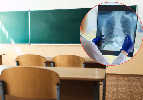 Potwierdzony przypadek gruźlicy w polskiej szkole! Setki dzieci i dorosłych zagrożonych - Sanepid rozpoczął procedury