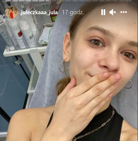 Zdjęcie Julia Wróblewska powiększyła usta! Jak wyszło? Sami oceńcie #1