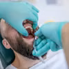 Absurdalne ceny u dentystów! Dlaczego jest tak drogo?