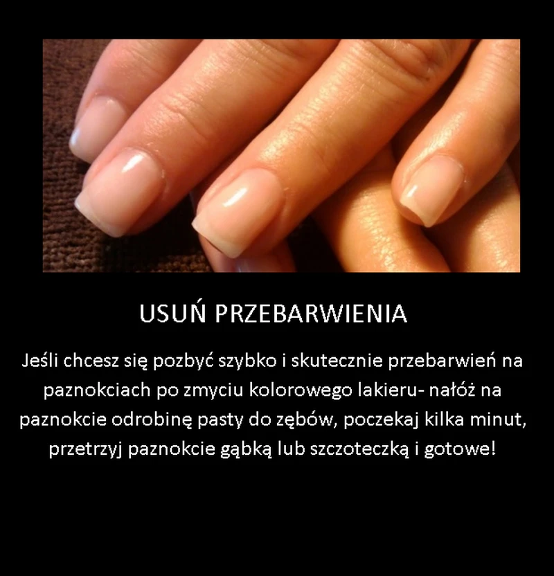 Super trik na usunięcie przebarwień po lakierze