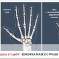 Światowy Dzień Reumatyzmu 12 październik - Reumatyzm jak opnanować stan zapalny