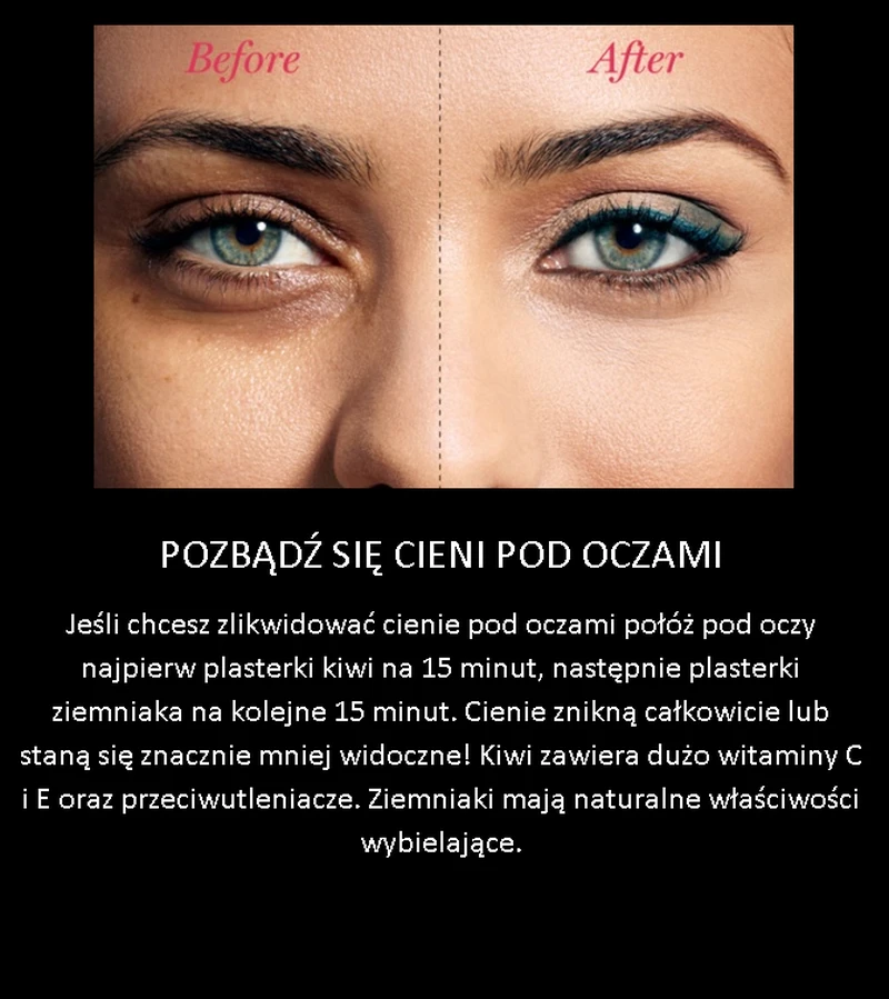 Jak pozbyć się ceni pod oczami
