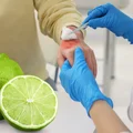 Poparzenia po limonkach? Niebezpieczna kombinacja, która może zrujnować skórę!