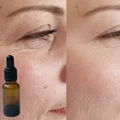 Jak prawidłowo stosować Retinol? 9 kluczowych zasad