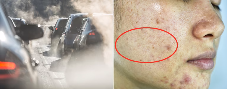 Smog – zobacz, w jaki sposób niszczy cerę!