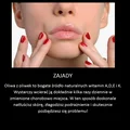 Domowy sposób za zajady