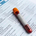 Darmowe badania krwi, cholesterolu i glukozy – program Profilaktyka 40 Plus kończy się już w grudniu!