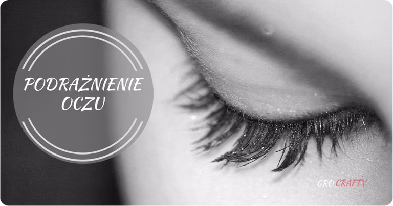 Podrażnione oczy – jak im pomóc?