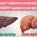 Poznaj 7 objawów uszkodzenia WĄTROBY! Lepiej ich nie ignoruj!