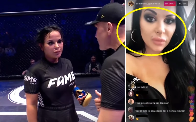 Pijana Godlewska komentuje swoją przegraną w Fame MMA! Winę zrzuca na sędziego