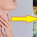 Te herbaty pomogą Ci jeżeli masz problemy z TARCZYCĄ