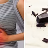 Jesz czekoladę żeby powstrzymać BIEGUNKĘ? Obalamy popularny mit!