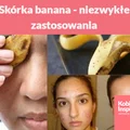Skórka banana - niezwykłe zastosowania