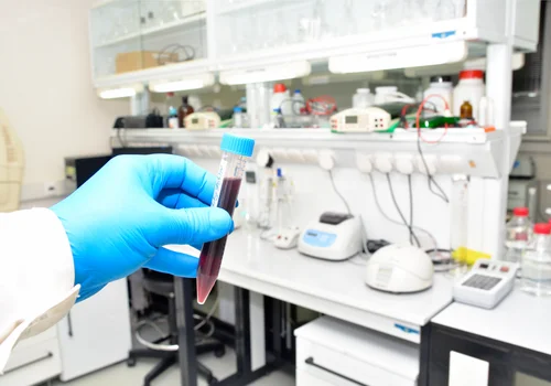 Dzień Diagnosty Laboratoryjnego: Kluczowa Rola w Systemie Opieki Zdrowotnej