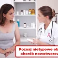 Zobacz objawy RAKA które często są ignorowane!
