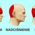 Pozbądź się BÓLU GŁOWY w 5 minut bez TABLETEK!