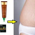 Masz rozstępy? Sprawdź ranking najlepszych produktów!