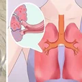 Kilka kropel tego olejku uwolni Cię od objawów każdej alergii!