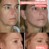 Face Fitness – ćwiczenie ujędrniające okolice oczu. [video]