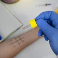Co warto wiedzieć przed wizytą u alergologa?  Jak wyjść z gabinetu z rozwiązaniem, nie kolejną wizytą