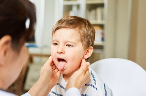 Angina: Bakteryjna czy Wirusowa? Jak je odróżnić? Kiedy antybiotyk? Sprawdź!