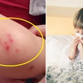 Jak uchronić dziecko przed alergią? Praktyczne i prawdziwe porady!
