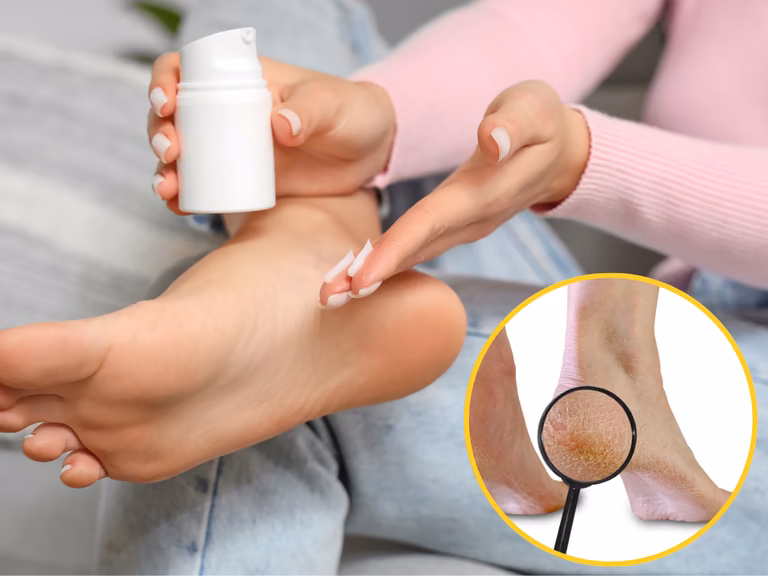 Szorstkie pięty? Ten krem na odparzenia dla niemowląt działa jak najlepszy peeling!