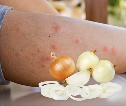 Odkryj potencjał cebuli! 11 zaskakujących zastosowań, które odmienią twoje codzienne życie!