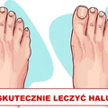 Masz HALUKSY? Sprawdź jak sobie z nimi radzić!
