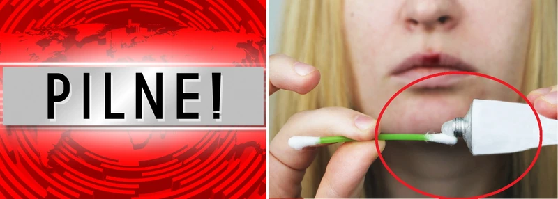 UWAGA: znany lek na trądzik wycofany z obrotu! [20.03.2019]