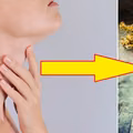 Te herbaty pomogą Ci jeżeli masz problemy z TARCZYCĄ