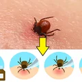 Jak wyciągnąć kleszcza! Instrukcja w 4 krokach