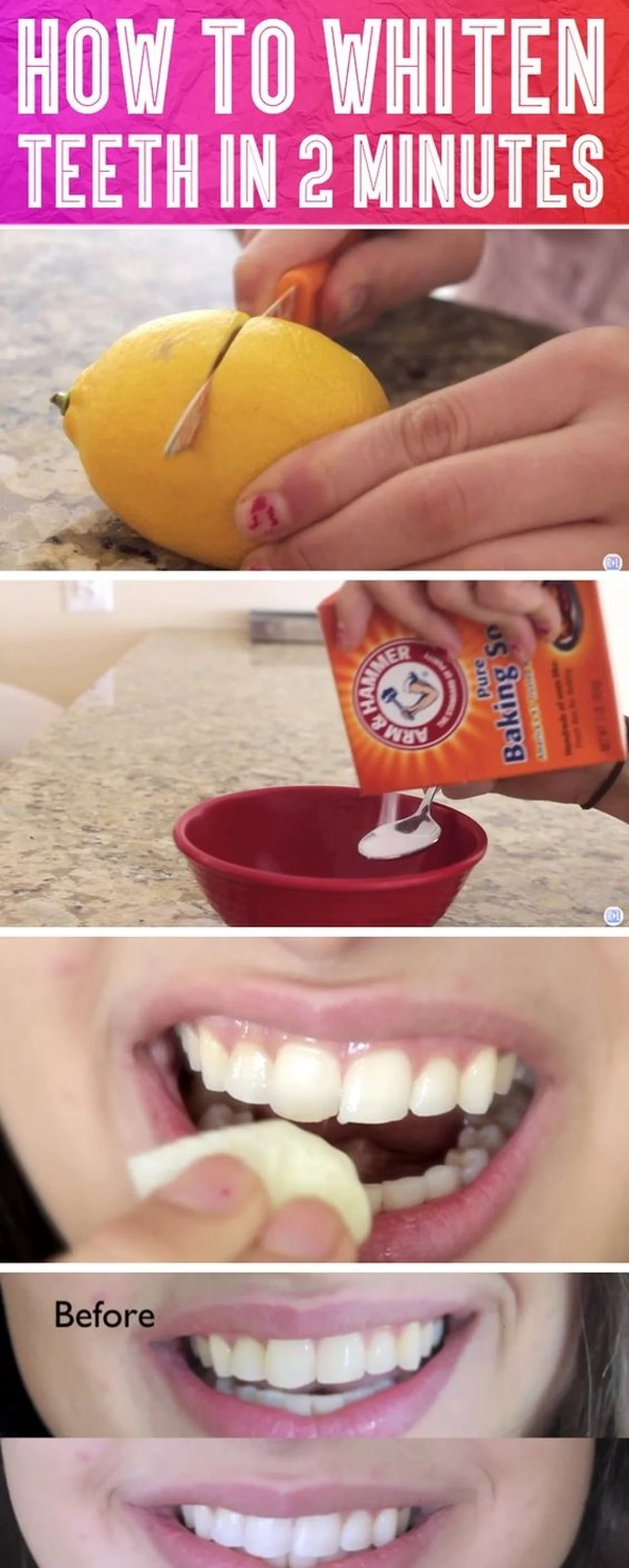 Domowy sposób na wybielanie zębów!