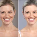 Jak przygotować sobie domowy PEELING?