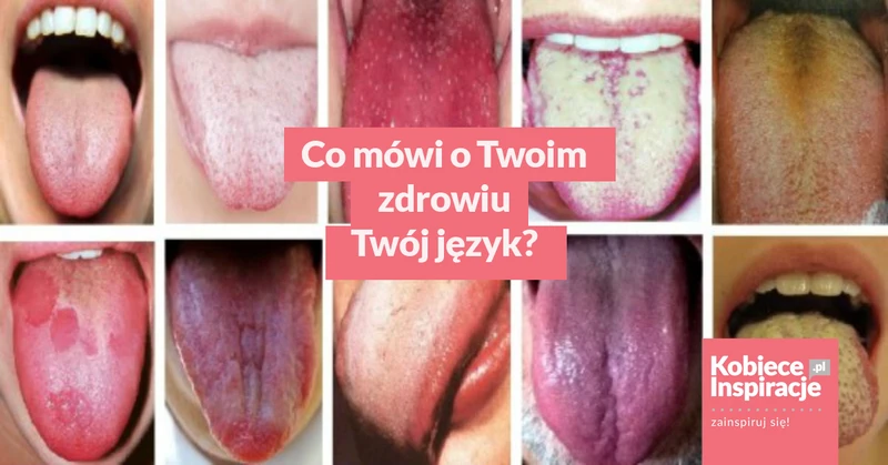 Co mówi o Twoim zdrowiu Twój język?