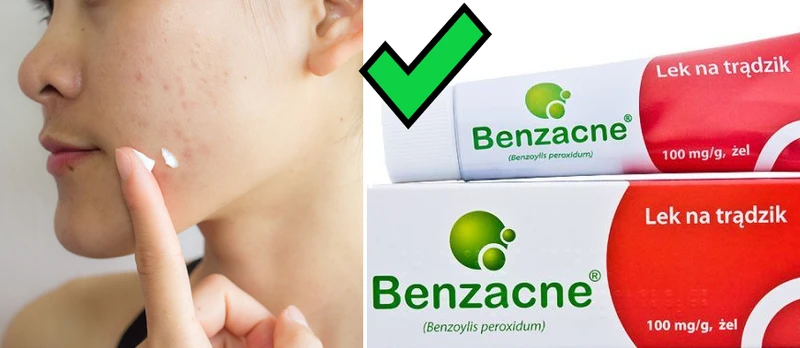 Benzacne - HIT z apteki na zaskórniki za kilkanaście zł!